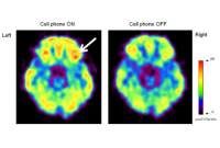 Η ακτινοβολία 4G των τηλεφώνων επηρεάζει τον εγκέφαλο